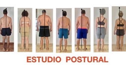 Estudio Postural